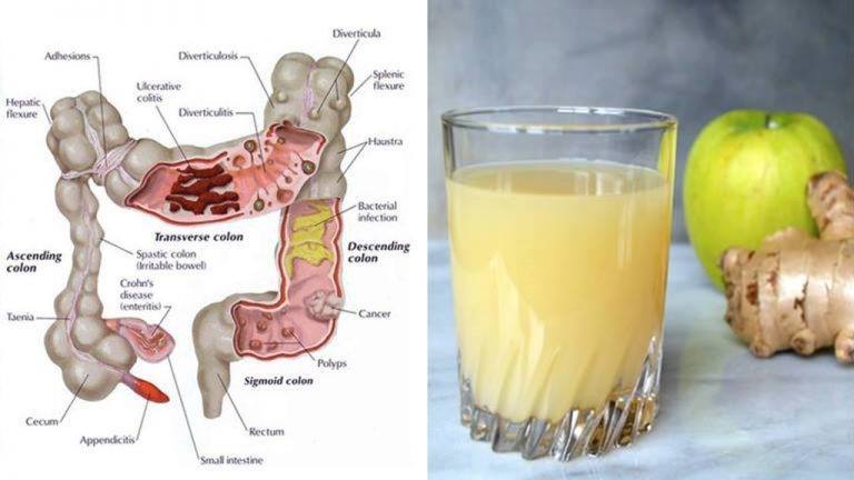 Cleansing juice of the colon with 3 ingredients: apples, ginger and lemon