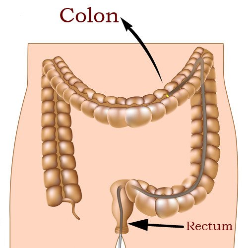The best foods for colon cleansing