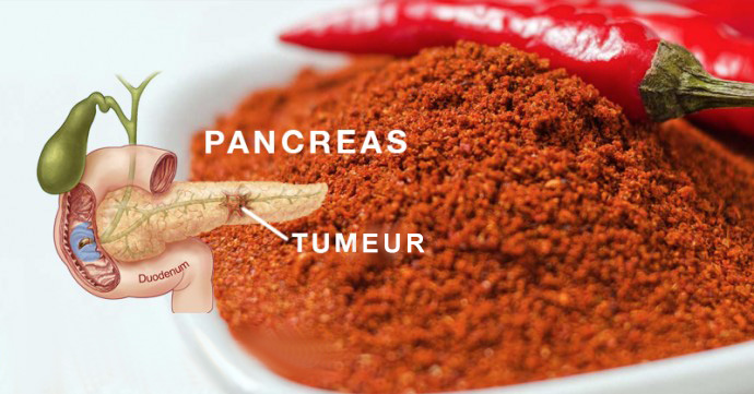épice commune qui détruit les cellules cancéreuses, stopper les crises cardiaques et reconstruit les intestins