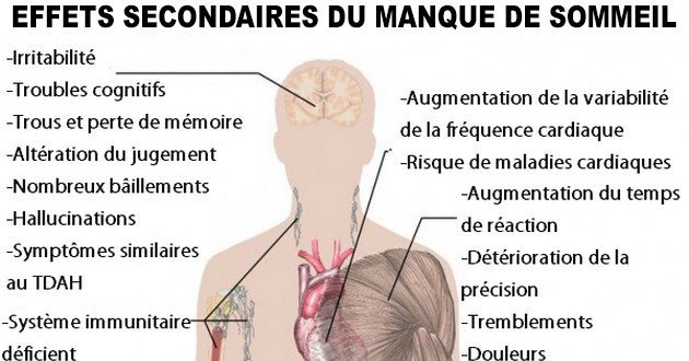 Voici une liste de maladies causées par le manque de sommeil : dépression, maladies cardiaques, diabète… Ne pas dormir tue